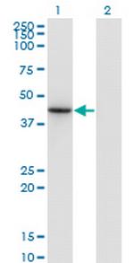 NEUROD6 Monoclonal Antibody (3G7)