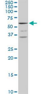 MCCC2 Polyclonal Antibody, MaxPab™