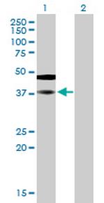 SAMSN1 Antibody in Western Blot (WB)