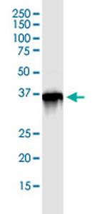PARVG Antibody in Immunoprecipitation (IP)