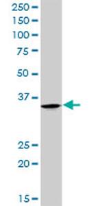 PARVG Antibody in Western Blot (WB)