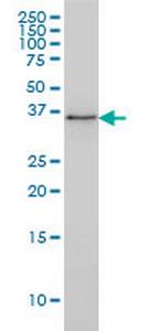 PARVG Monoclonal Antibody (4E1)