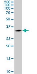 CENPK Polyclonal Antibody, MaxPab™
