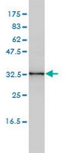 CENPK Monoclonal Antibody (1G2-1B10)