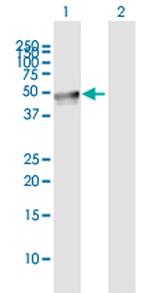 LEPRE1 Polyclonal Antibody, MaxPab™