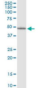 LHX5 Monoclonal Antibody (2C6)