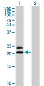 MS4A5 Antibody in Western Blot (WB)