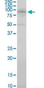 RFWD2 Antibody in Western Blot (WB)