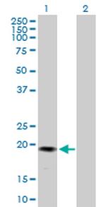 GREM2 Polyclonal Antibody, MaxPab™