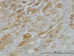 HHIP Monoclonal Antibody (5D11)