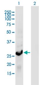 RGS18 Antibody in Western Blot (WB)