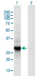 RGS18 Monoclonal Antibody (1G12)