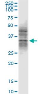 ATG3 Monoclonal Antibody (1G3)