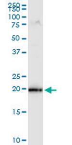 MRPS25 Monoclonal Antibody (3E6)
