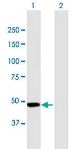 CPEB1 Antibody in Western Blot (WB)