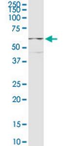 CPEB1 Polyclonal Antibody, MaxPab™