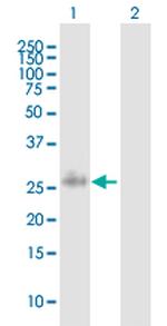 PLA2G2F Polyclonal Antibody, MaxPab™