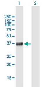 SMYD3 Antibody in Western Blot (WB)