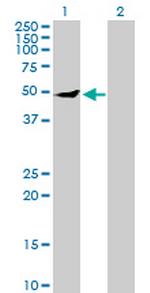 IPPK Antibody in Western Blot (WB)