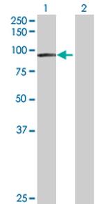 EPS8L2 Antibody in Western Blot (WB)