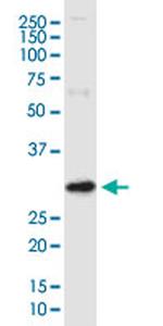 ARV1 Monoclonal Antibody (4G12)
