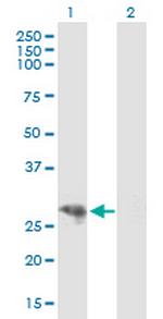 CYP3A43 Antibody in Western Blot (WB)