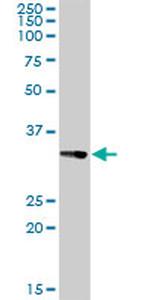 CENPH Antibody in Western Blot (WB)