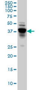 NDRG4 Monoclonal Antibody (2G3)