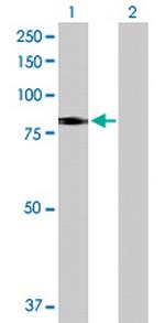 SLC26A6 Antibody in Western Blot (WB)