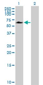 ACD Polyclonal Antibody, MaxPab™