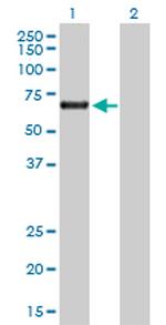 ACD Polyclonal Antibody, MaxPab™