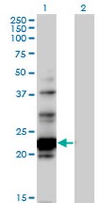 NOL6 Polyclonal Antibody, MaxPab™
