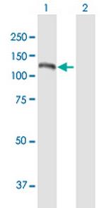 NOL6 Polyclonal Antibody, MaxPab™