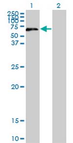 UPF3A Monoclonal Antibody (2E2)