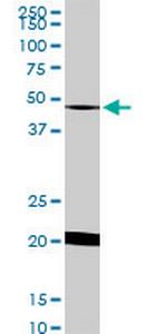 NADK Monoclonal Antibody (5F4)