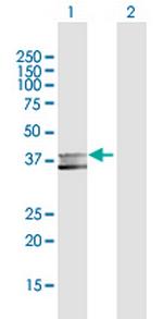 MPPE1 Polyclonal Antibody, MaxPab™