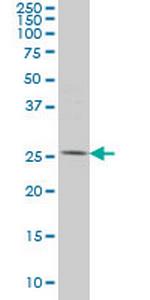 PYCRL Monoclonal Antibody (4F11)