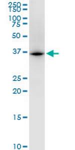 UBE2Z Monoclonal Antibody (4B1)
