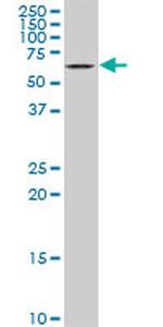 STK33 Antibody in Western Blot (WB)