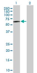 STK33 Polyclonal Antibody, MaxPab™