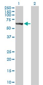 STK33 Polyclonal Antibody, MaxPab™