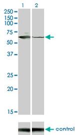 STK33 Antibody in Western Blot (WB)