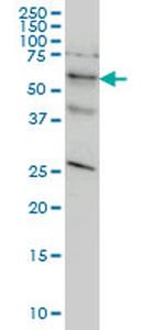 STK33 Antibody in Western Blot (WB)