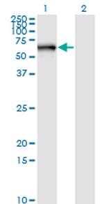 STK33 Antibody in Western Blot (WB)