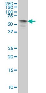 STK33 Antibody in Western Blot (WB)