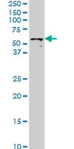STK33 Antibody in Western Blot (WB)