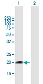 FUNDC2 Polyclonal Antibody, MaxPab™