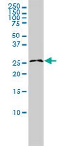 RASL11B Monoclonal Antibody (1B5)