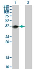 BOLL Monoclonal Antibody (1E3)