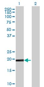DUSP26 Polyclonal Antibody, MaxPab™